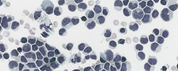 Close-up of HIV cells.